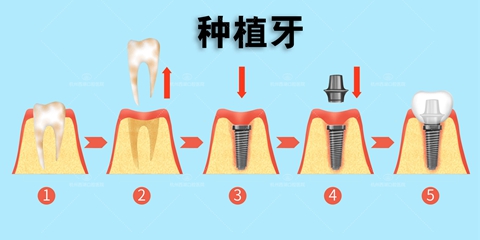 攝圖網