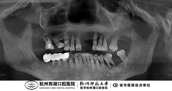 2022012106454346